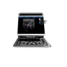 ecografo portatil chison ebit30