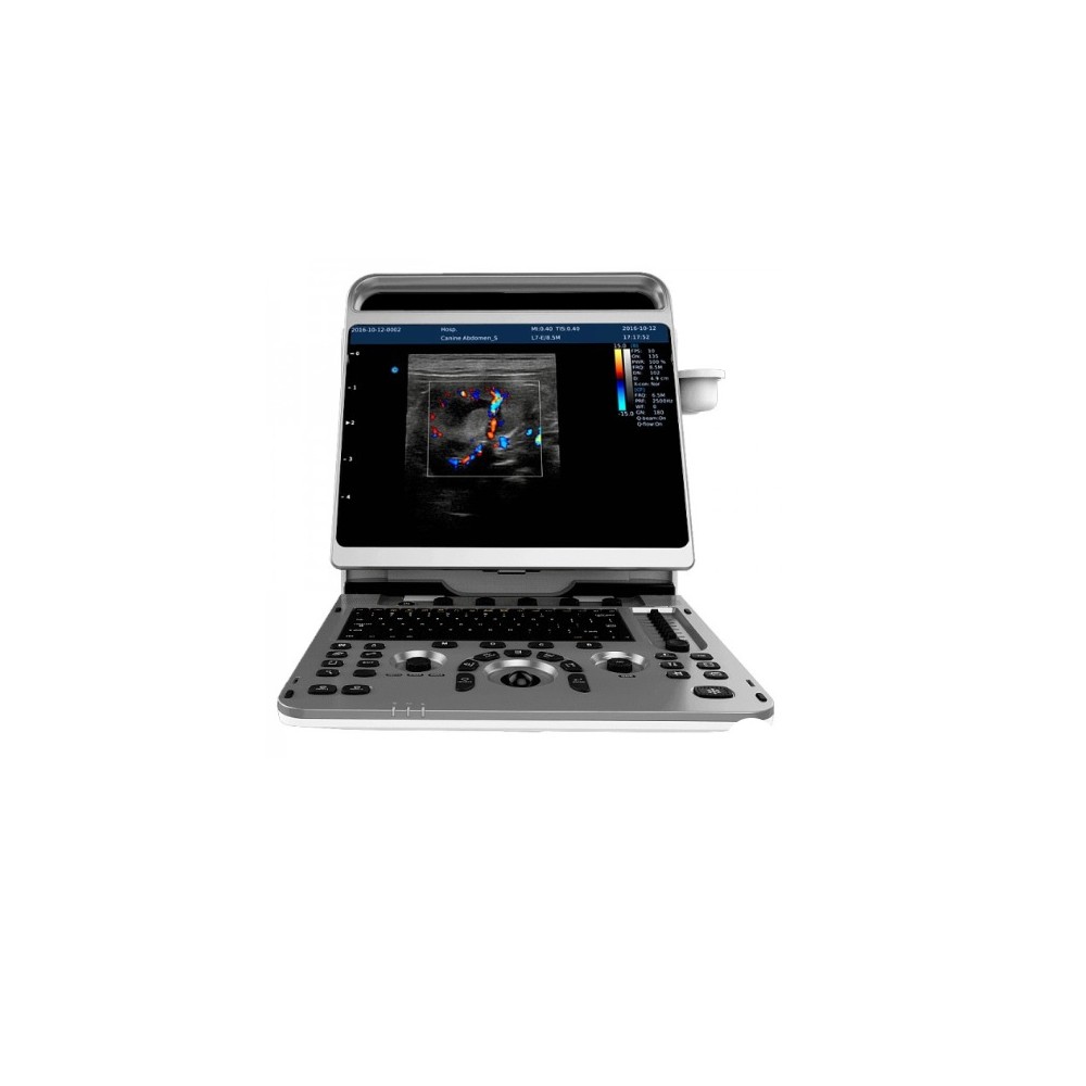 ecografo portatil chison ebit30